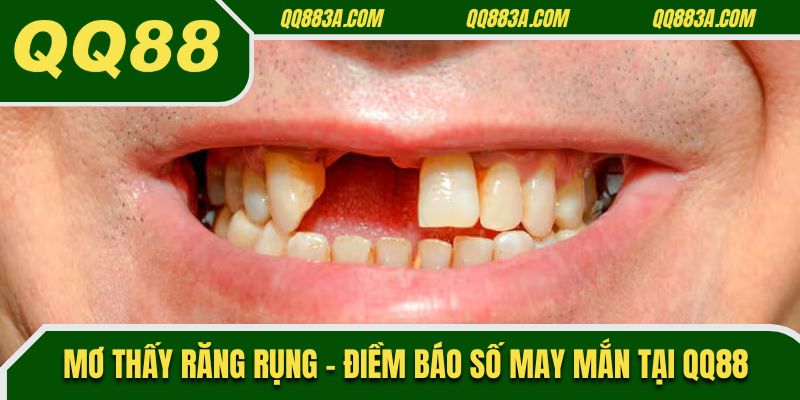 Mơ Thấy Răng Rụng